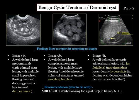 Pin By Grace Ortiz On Ultrasound Diagnostic Medical Sonography