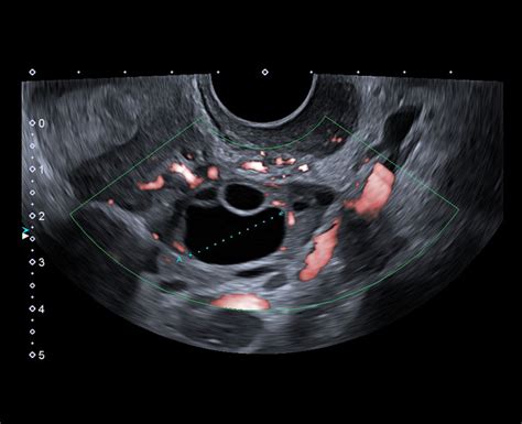 Advanced Pelvic Ultrasound Assessment Clinical Diagnostics