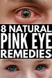 Pin by cameronkb3jl0 on Health | Natural pink eye remedy, Pinkeye ...