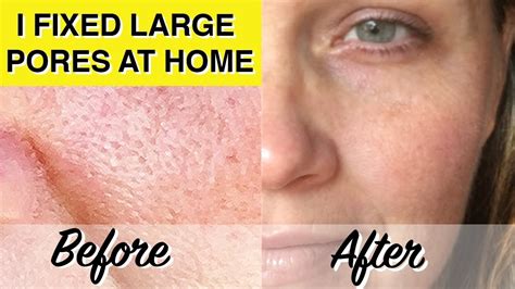 Sajy Glycolic Acid Peel Repair Solution Shrink Pores Brighten Skin