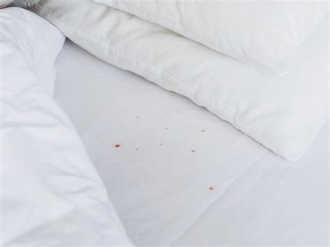 How To Get Bed Bug Stains Out Of Sheets Pest Phobia
