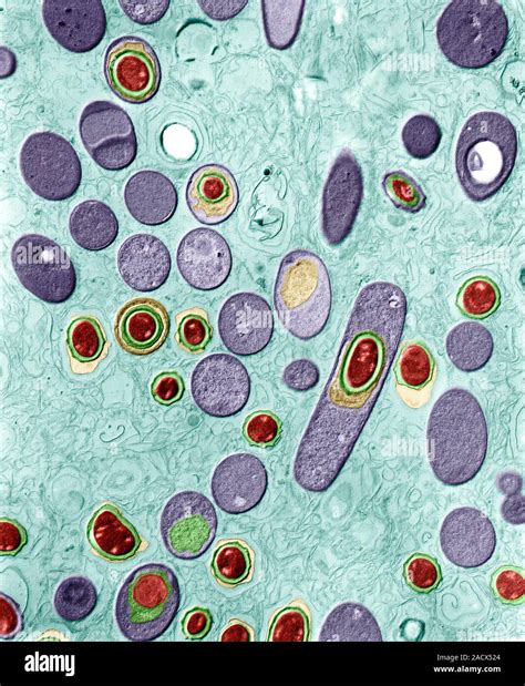 Anthrax Bacteria Coloured Transmission Electron Micrograph Tem Of