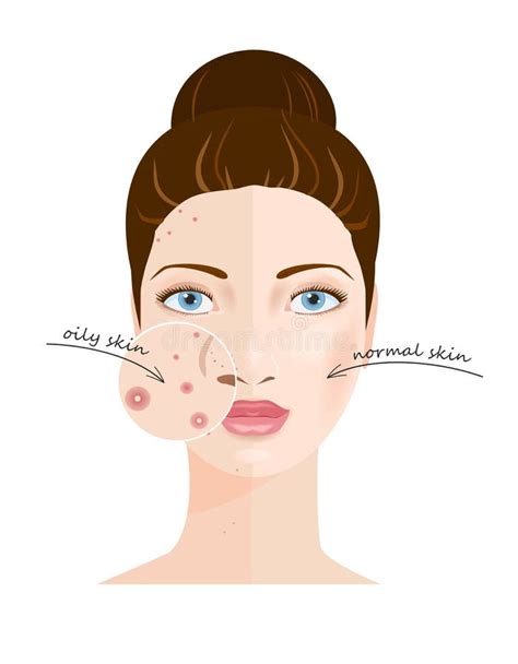 Problem Skin Care Infographic Stock Vector Illustration Of Lens