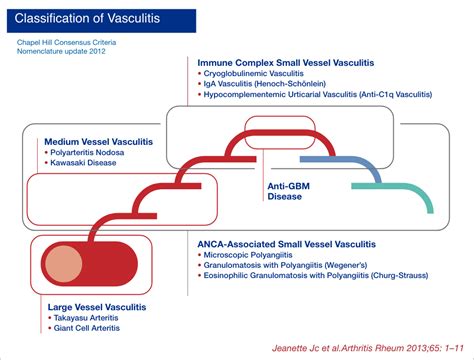 Vasculitis Types And Treatments Grifols Diagnostics