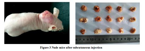 A Study On Establishment Of Tumor Model By Subcutaneous Injection And