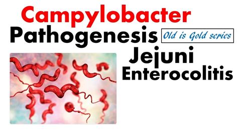 Campylobacter Pathogenesis Jejuni And Enterocolitis Youtube