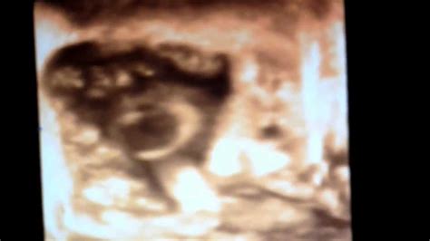 2 anak sebelum ni tak pernah terlebih minggu. Perkembangan Janin 5 bulan #BabyG | USG hamil 20 minggu ...
