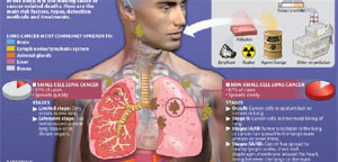 Radon Causes Lung Cancer