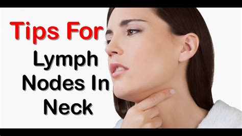 Swollen Lymph Nodes In Neck Causes And Treatment Vrogue Co