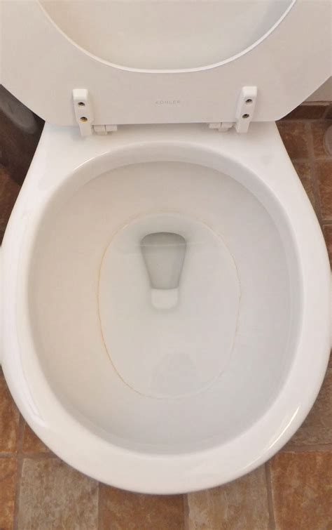 Help Need How To Unblock Toilet Please Musely