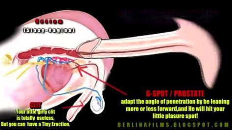 Diagram Pictures Brachial Plexus Anatomy Kenhub Porn Sex Picture