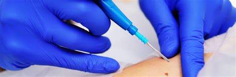 How can people with dark skin get skin cancer? Can Skin Cancer Come Back After Mohs Surgery - VishwaRaj ...