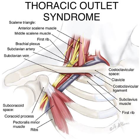 Thoracic Outlet Syndrome Structura Body Therapies