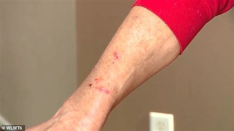 Ohio Woman 49 Mauled By One Or Both Of Her Aggressive Great Danes