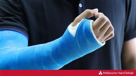 Exercises For Your Arm And Hand While In A Cast Melbourne Hand