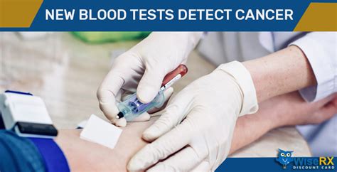 New Blood Tests Detect Cancer Is It True Wiserxcard