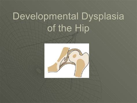 Developmental Dysplasia Of The Hip And Ultrasound