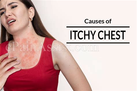 Causes Of Itchy Chest And Its Treatment