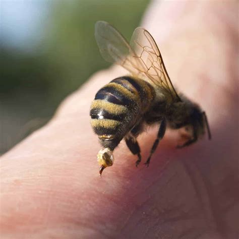 Understanding Avoiding And Coping With Bee Stings Perfectbee