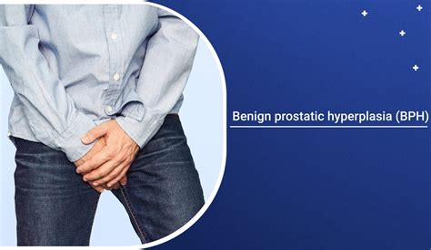 Benign Prostatic Hyperplasia Bph Symptoms And Causes