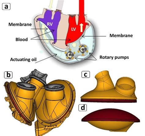 A Carmat Total Artificial Heart With Left Lv And Right Ventricles