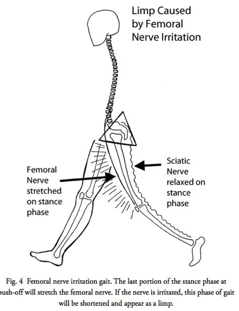 Walking Disorders How Nerve And Joint Injuries Change Gait