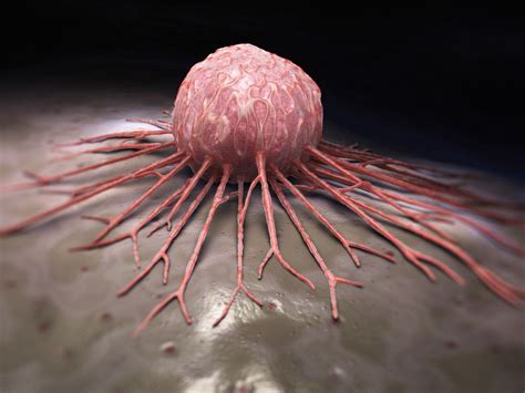 Super Tumor Suppressor Found To Prevent Pancreatic Cancer