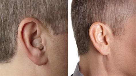 They cover your entire ear and press against your skull, offering a complete, immersive experience. ITC vs IIC - In the Ear Canal Hearing Aid vs Invisible In ...
