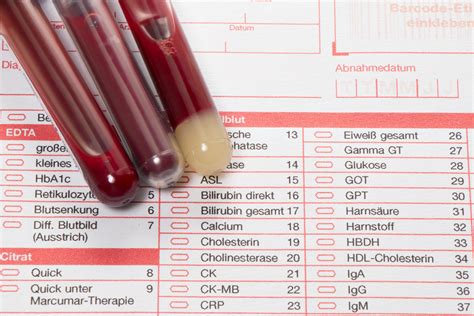 A comprehensive guide to normal lab values laboratory tests are procedures wherein a sample of blood, urine, other bodily fluid or tissue are checked in order to know more about a person's health. Dying With Normal Lab Values: Numbers Count But There's ...