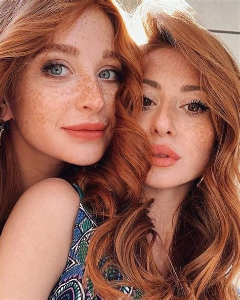 Pin By Andrew Rawlings On Redheads Beautiful Freckles Beautiful Red
