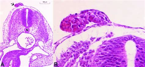 2 Photomicrographs A A Tract Of Tissue Arrow Protrudes From The