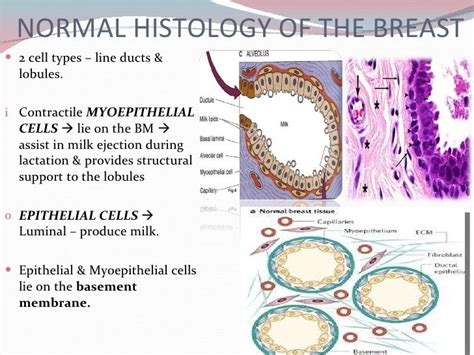 Breast Benign Disorders Pathology