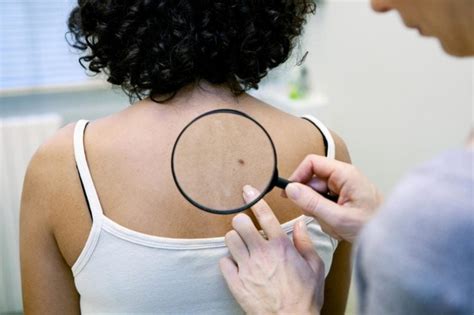 Breakthrough Melanoma Treatment Could Save Thousands Of Lives Reader