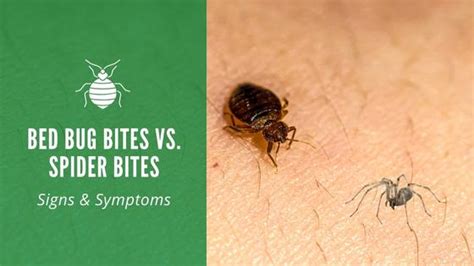 Bed Bug Bites Vs Spider Bites Compare Signs And Symptoms