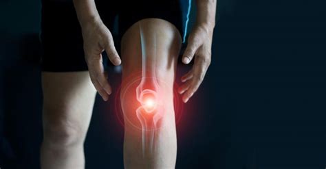 Ai Detects Early Knee Osteoarthritis From X Ray Images Inside