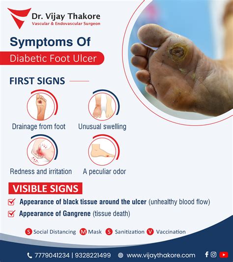 Quick Facts Diabetic Foot Ulcers In Diabeti Vrogue Co