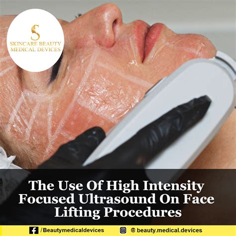 The Use Of High Intensity Focused Ultrasound On Face Lifting Procedures
