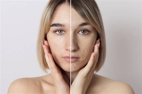 Dry Vs Dehydrated Skin How To Tell The Difference Peche