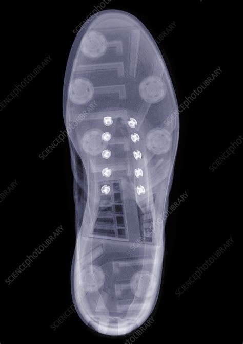 Shoe Sole X Ray Stock Image F0299464 Science Photo Library