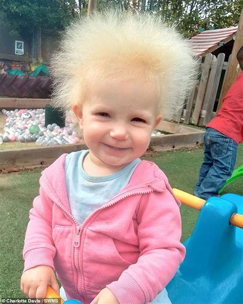 A Toddler Nicknamed Einstein Is One Of Only 100 People In The World