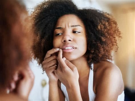 Blind Pimple Under The Skin 6 Ways To Treat It