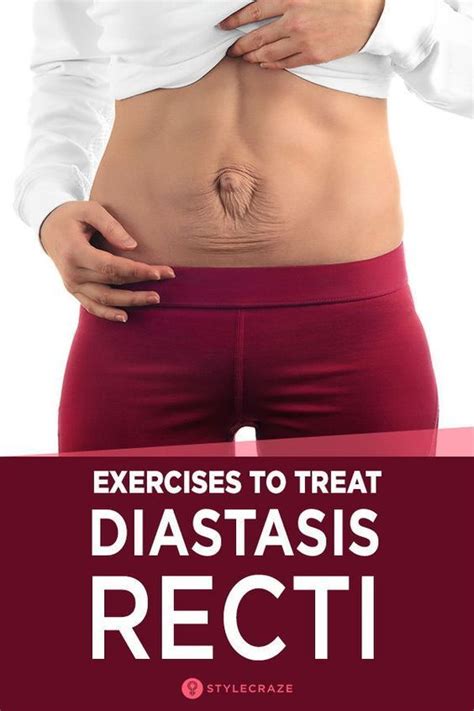 11 Exercises For Diastasis Recti That Strengthen Your Core Diastasis