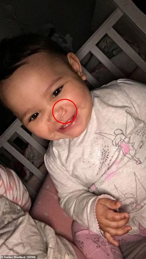 Mum Fears Baby Scarred For Life After She Was Slashed In The Face With