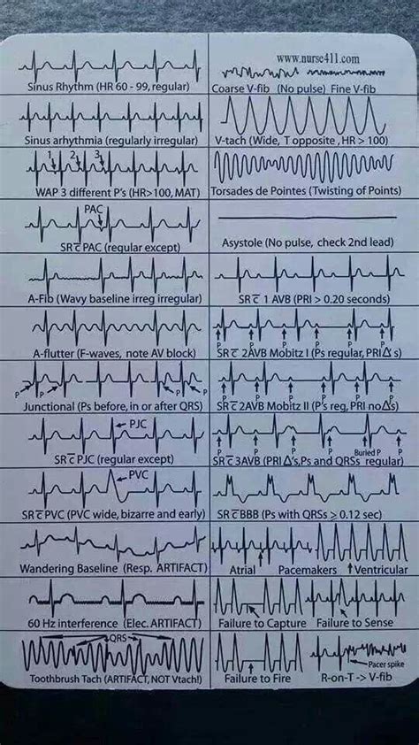 Coarse V Fib Ecg Theme Arabic