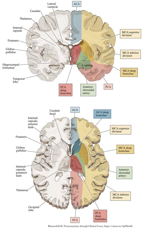 Acute Ischemic Stroke Ais Emcrit Project