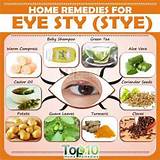 An Eye Stye Home Remedies Pictures