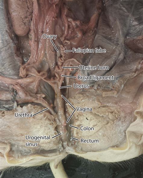 In the simplest form, the male inguinal canal contains only the spermatic cord in addition to the same nerves found in the female inguinal canal. Reproductive System Dissection Photos