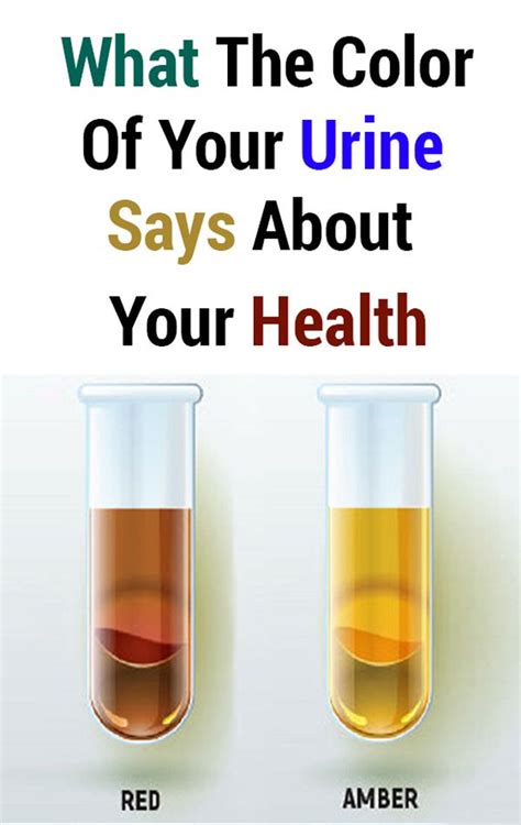 What The Color Of Your Urine Says About Your Health Health How To Stay Healthy Womens Health