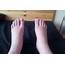Swelling Of Feet And Ankle Its Causes Treatment  MTatva Health PIE