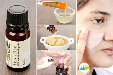Tea tree oil directly attacks acne causing bacteria. How to Use Tea Tree Oil for Acne: 7 Popular Remedies | Fab How